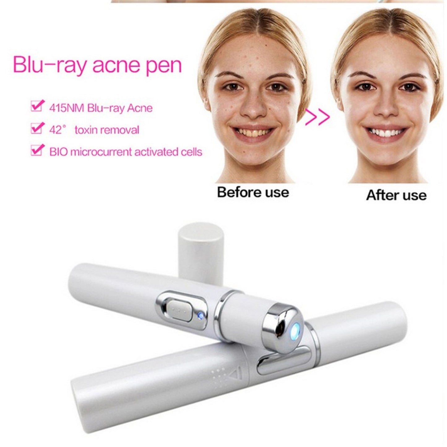 Laser Pen Soft Scar Wrinkle/Acne Removal Device