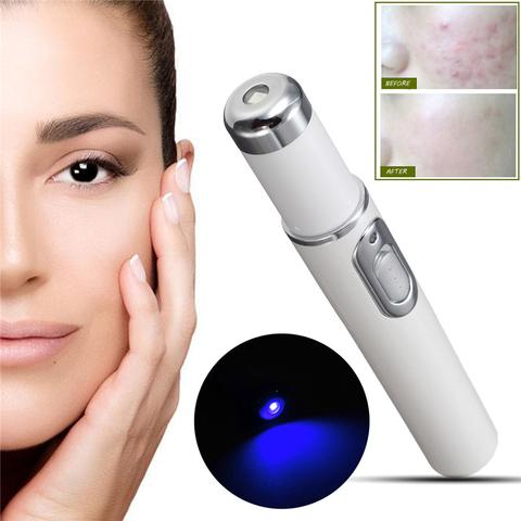 Laser Pen Soft Scar Wrinkle/Acne Removal Device